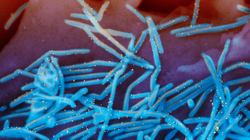 FILE - This electron microscope image provided by the National Institutes of Health shows...